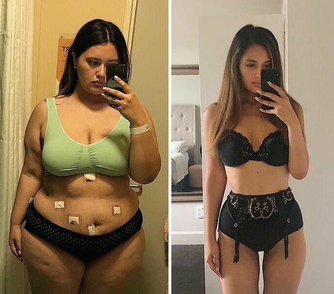 Mädchen vor und nach Gewichtsverlust mit KETO Complete Kapseln
